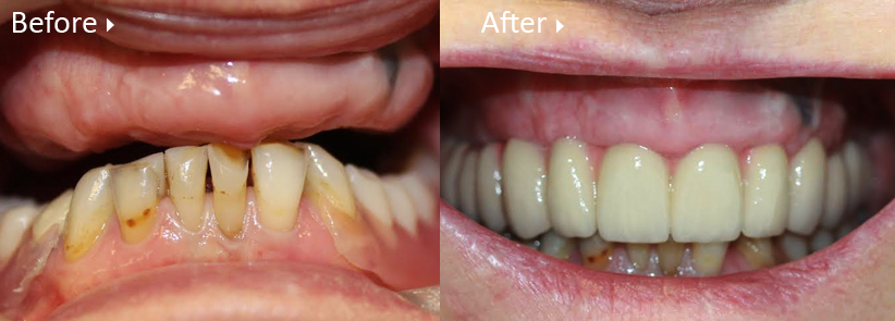 https://leemingdentalclinic.co.uk/wp-content/uploads/2025/07/allfour.jpg