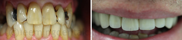 https://leemingdentalclinic.co.uk/wp-content/uploads/2025/07/cosmeticgal.jpg