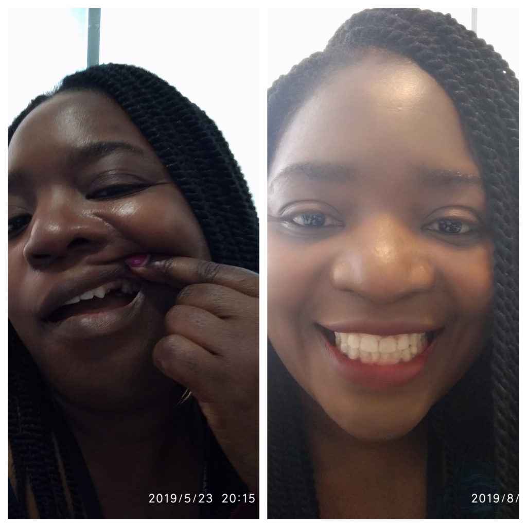 https://leemingdentalclinic.co.uk/wp-content/uploads/2025/07/dentalimplants.jpg