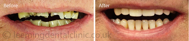 https://leemingdentalclinic.co.uk/wp-content/uploads/2025/07/forgal.jpg